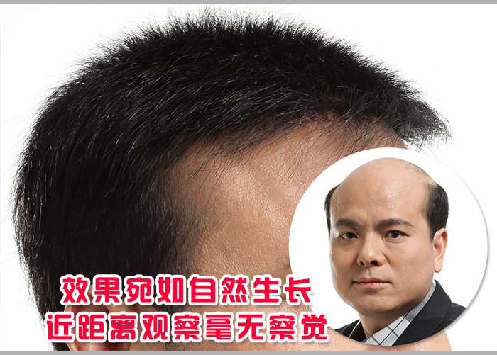 透氣假發(fā) \
