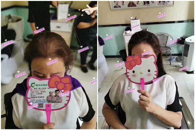 劉海片狀假發(fā) \