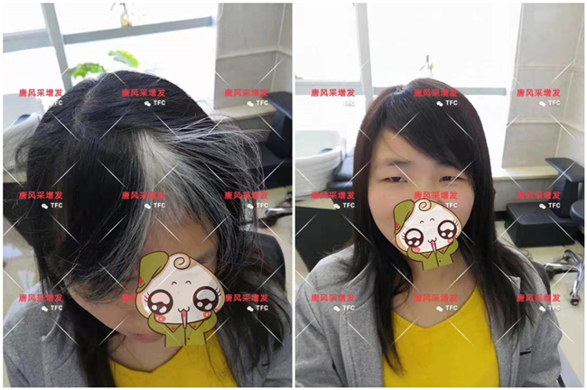 染發(fā)好還是戴假發(fā)好 \