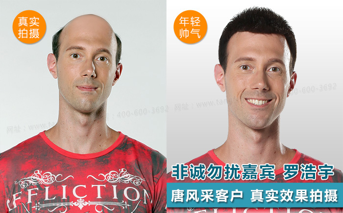 唐風(fēng)采假發(fā) \