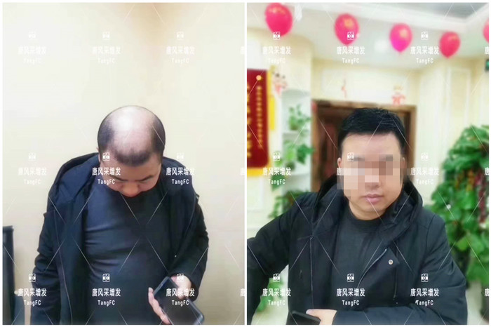 唐風(fēng)采假發(fā) \