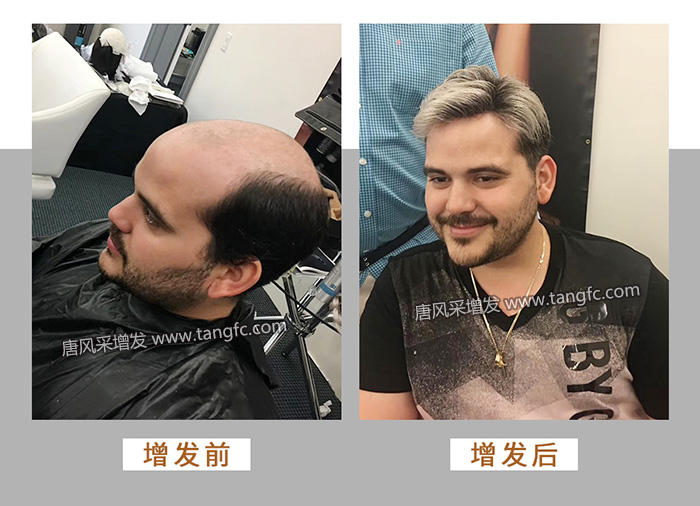 唐風(fēng)采假發(fā) \