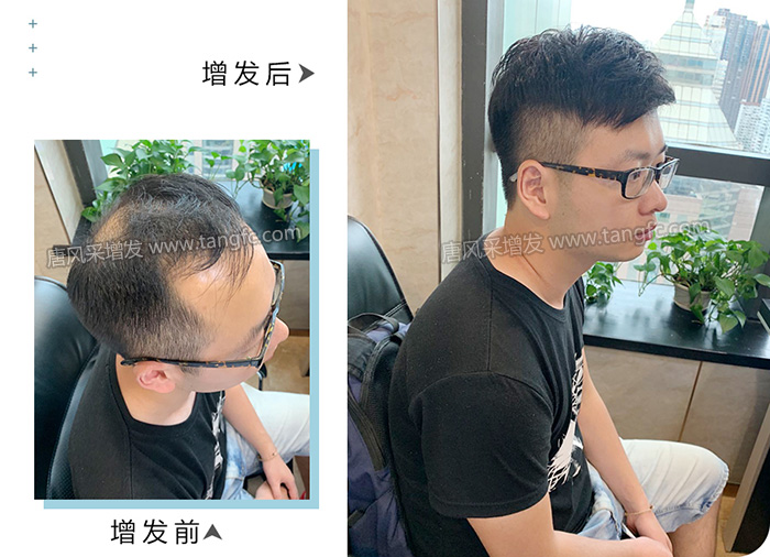 唐風(fēng)采假發(fā) \