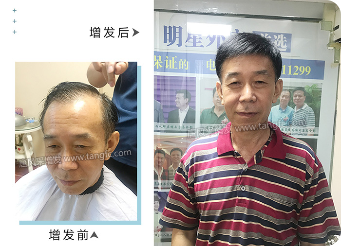 唐風(fēng)采假發(fā) \