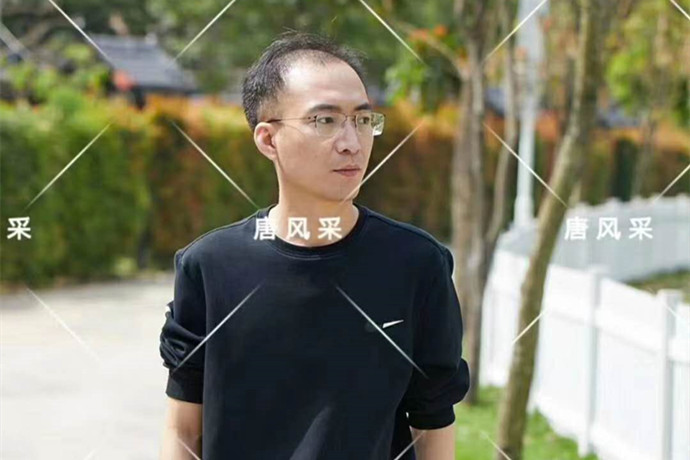 前額補(bǔ)發(fā)假發(fā)片 \