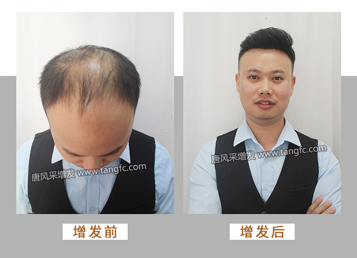 真人發(fā)假發(fā) \