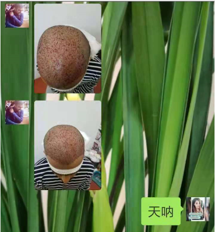 真人發(fā)假發(fā) \