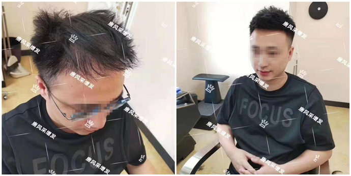 真發(fā)假發(fā) \