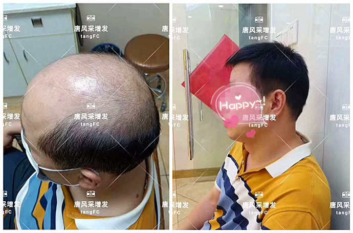 真人發(fā)假發(fā) \