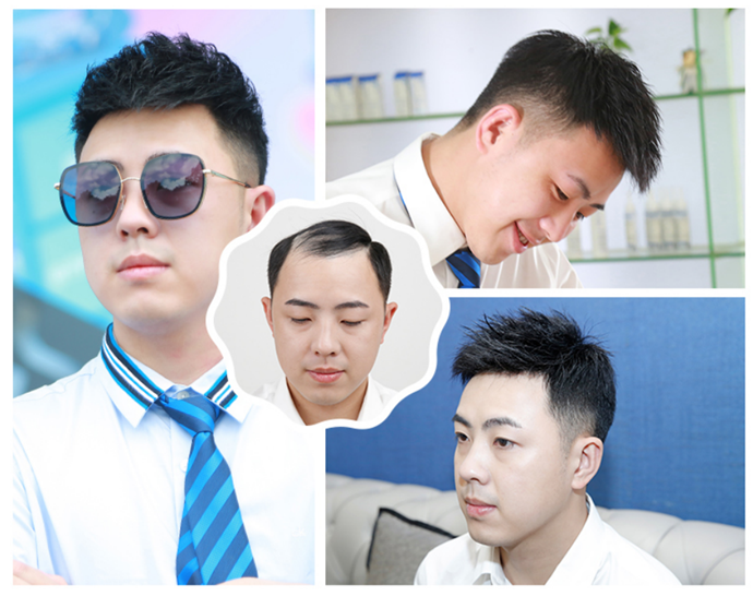 局部假發(fā)片 \