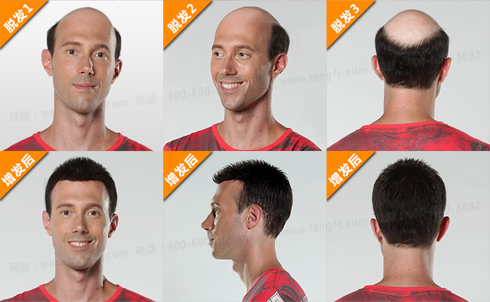 買假發(fā)需要注意哪些 \