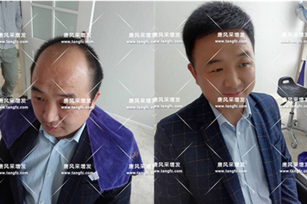 購(gòu)買假發(fā) \