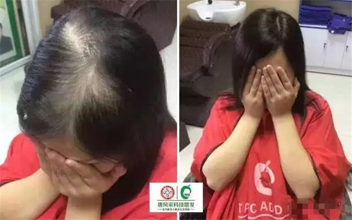 假發(fā)片看得出來嗎 \