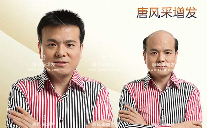 人發(fā)假發(fā) \