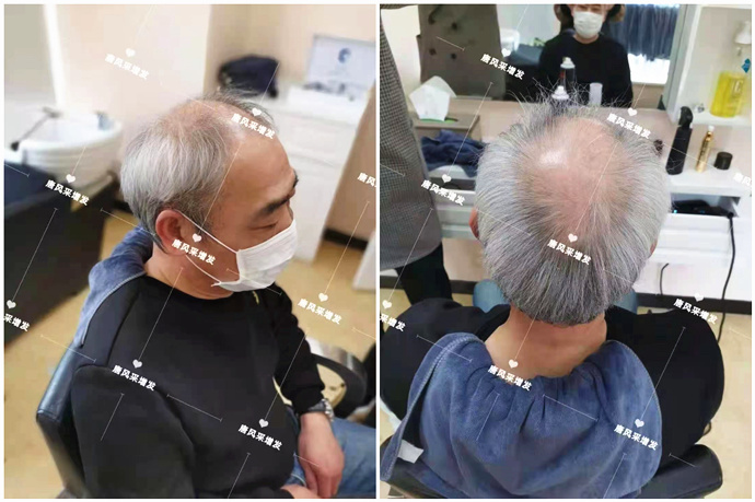 假發(fā)片發(fā)夾 \