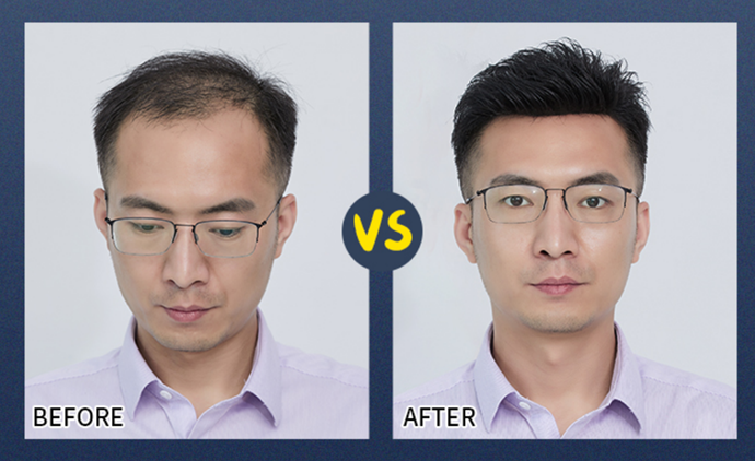 男士夏天戴假發(fā) \