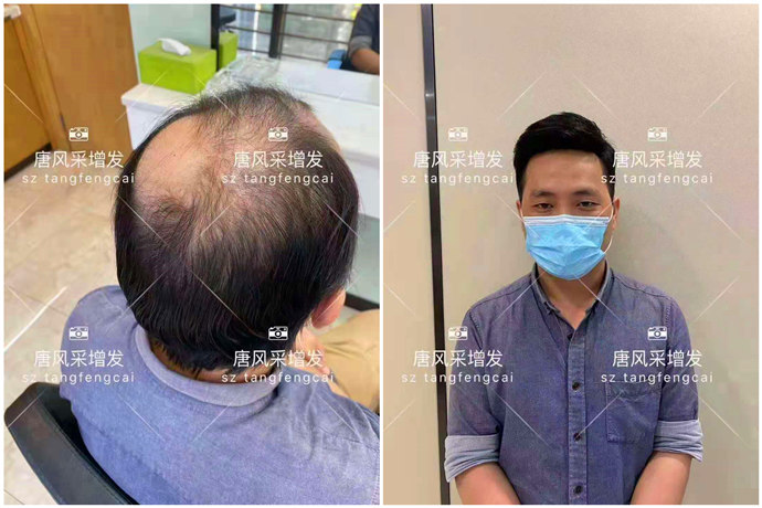 男士夏天戴假發(fā) \