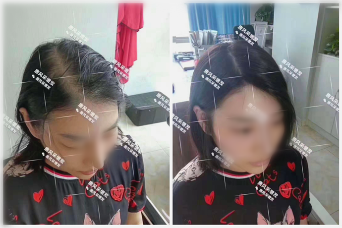 中老年女士假發(fā) \