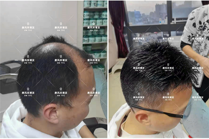 男士真發(fā)假發(fā)套 \