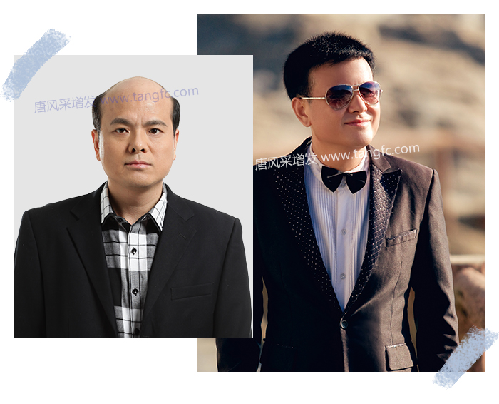 郴州假發(fā)購(gòu)買(mǎi) \