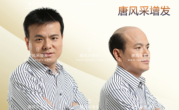 東莞男士假發(fā)片 \