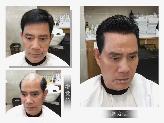 東莞中老年選假發(fā) \