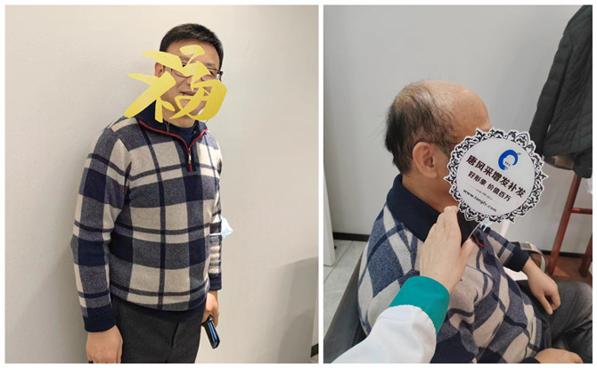 東莞中老年選假發(fā) \