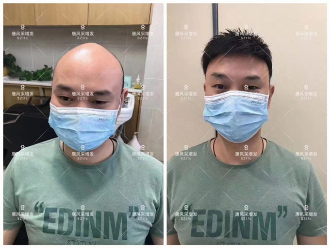 紹興高檔假發(fā) \