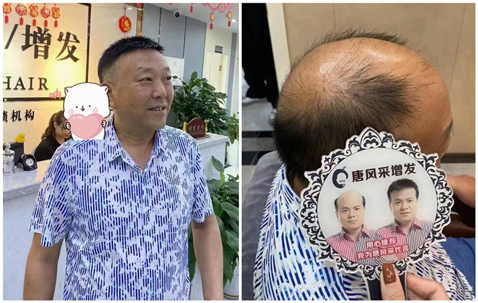 長(zhǎng)沙假發(fā)實(shí)體店 \