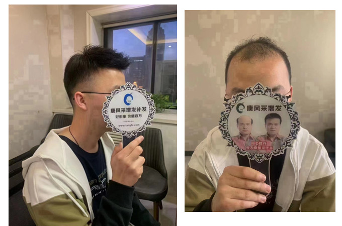 南昌哪有假發(fā)實體店 \