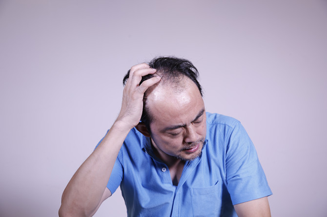 成都哪有品質假發(fā)店 \