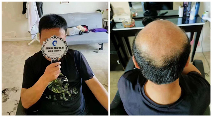 成都哪有品質假發(fā)店 \