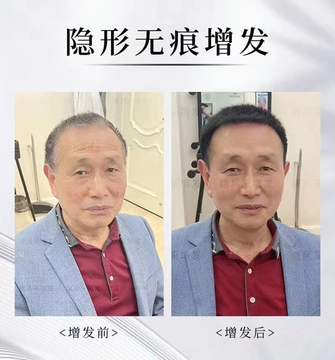 昆明假發(fā)實(shí)體店 \