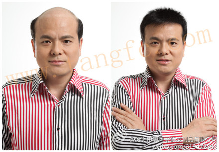 北京買隱形假發(fā)哪家好？效果好性價(jià)比高就選它