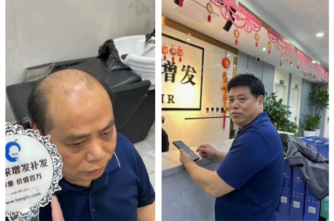 寧夏銀川假發(fā)店 \