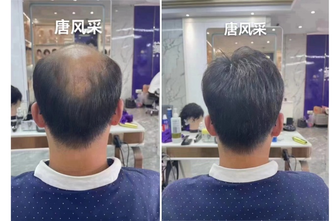 寧夏銀川假發(fā)店 \