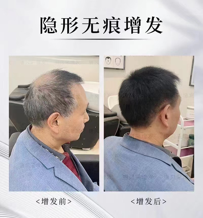 寧夏銀川假發(fā)店 \