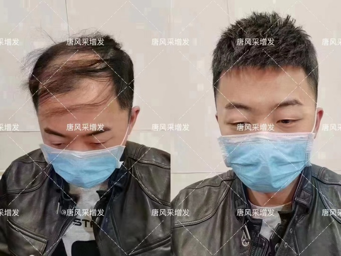 定制假發(fā)佩戴體驗(yàn) \