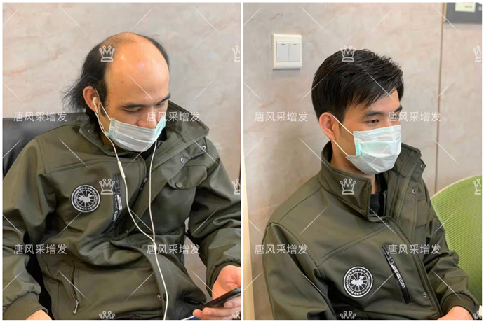 粘貼隱形假發(fā)片 \