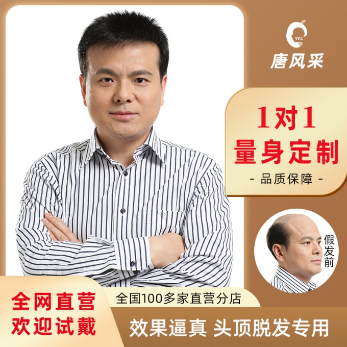 溫州隱形補(bǔ)發(fā)假發(fā) \