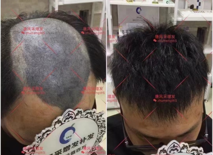 大叔戴假發(fā) \