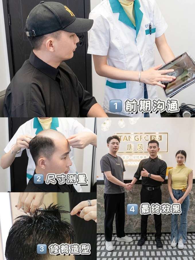 長(zhǎng)沙假發(fā)定制哪家好 \