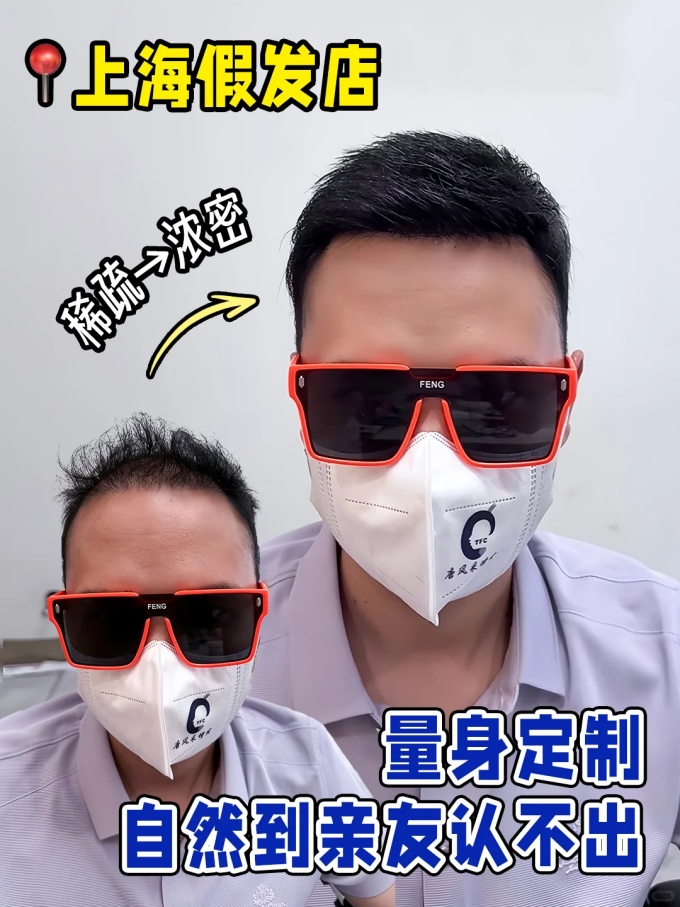 上海假發(fā)定制 \