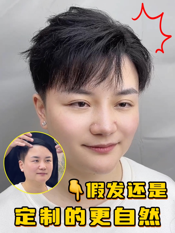 廈門假發(fā),發(fā)量變多 \