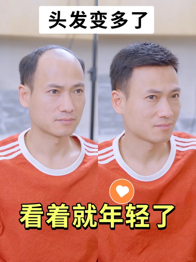 北京高端假發(fā)定制 \