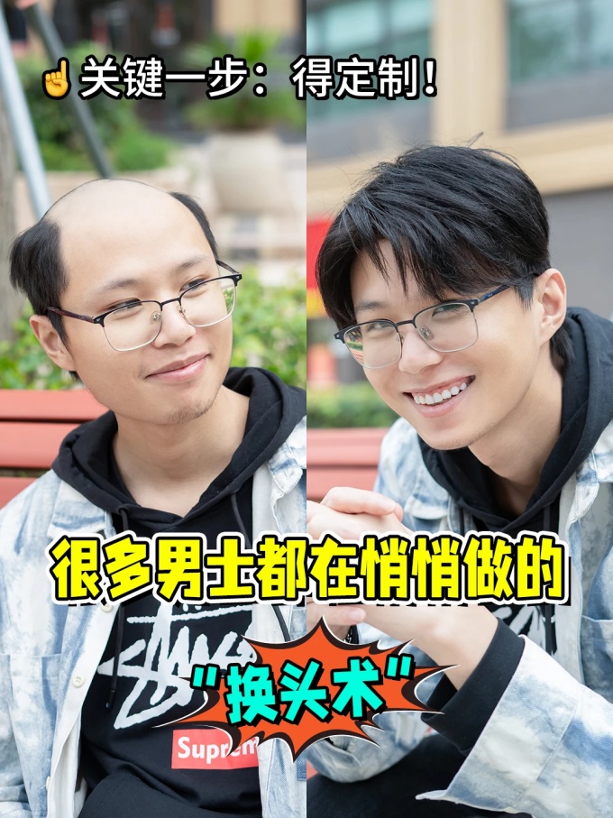 男士假發(fā),干貨分享 \