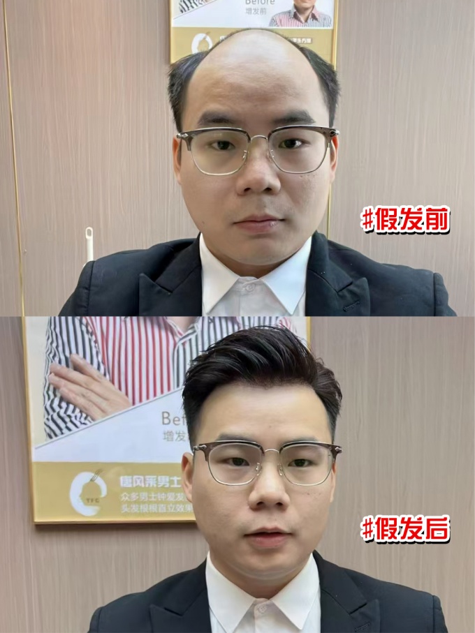 長沙假發(fā)定制 \