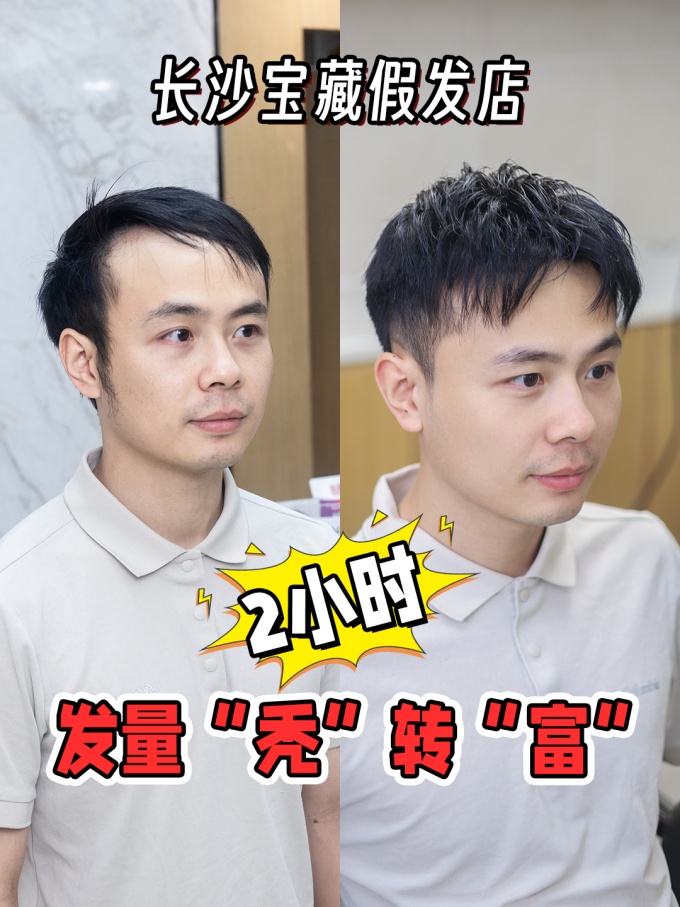 男生發(fā)型,長沙假發(fā)店 \