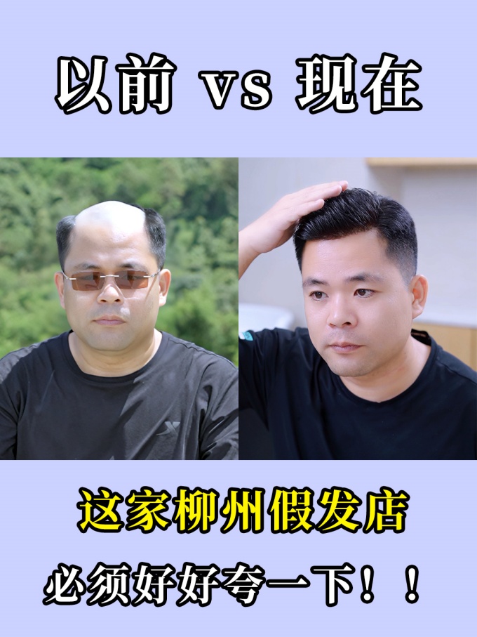 柳州陽光100城市廣場,發(fā)量少,白發(fā) \