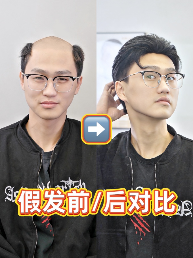 貴陽假發(fā)哪家好,假發(fā)效果 \